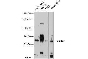 Western blot analysis of extracts of various cell lines, using SLC1 antibody  at 1:1000 dilution. (SLC1A6 抗体  (AA 155-265))