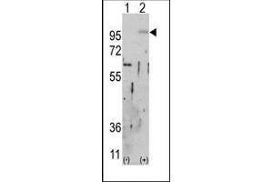 Western blot analysis of FGFR2 (arrow) using rabbit polyclonal FGFR2 Antibody. (FGFR2 抗体)