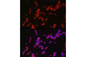 Immunofluorescence analysis of SH-SY5Y cells using nNOS Rabbit mAb (ABIN1680436, ABIN1680435, ABIN7101483 and ABIN7101484) at dilution of 1:100 (40x lens). (NOS1 抗体)