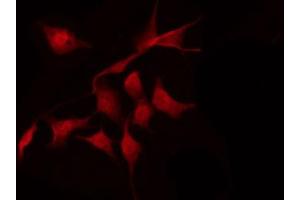 Immunofluorescence (fixed cells) (IF/ICC) image for anti-Tumor Protein P53 (TP53) (pSer392) antibody (ABIN6256312)