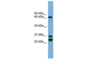 WB Suggested Anti-DNAI2 Antibody Titration:  0. (DNAI2 抗体  (N-Term))