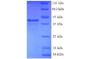 SDS-PAGE (SDS) image for Eukaryotic Translation Initiation Factor 1 (EIF1) (AA 1-113), (full length) protein (GST tag) (ABIN5712383) (EIF1 Protein (AA 1-113, full length) (GST tag))