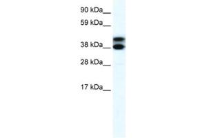 Western Blotting (WB) image for anti-Tripartite Motif Containing 13 (TRIM13) antibody (ABIN2460875) (TRIM13 抗体)