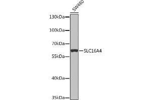 Western Blotting (WB) image for anti-Solute Carrier Family 16 (Monocarboxylic Acid Transporters), Member 4 (SLC16A4) (AA 250-350) antibody (ABIN7270403)