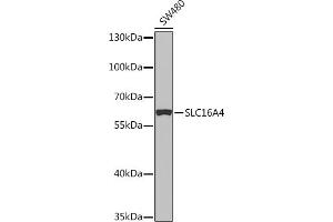 Western blot analysis of extracts of SW480 cells, using SLC16 Rabbit pAb (ABIN7270403) at 1:1000 dilution. (SLC16A4 抗体  (AA 250-350))