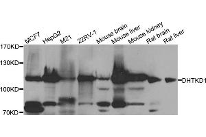 Western blot analysis of extracts of various cell lines, using DHTKD1 antibody (ABIN5974840) at 1/1000 dilution. (DHTKD1 抗体)