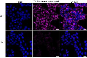 Immunocytochemical staining of HeLa cells using TNF receptor associated protein 1 antibody (ABIN7800567), 1:1,000), Top panel: wild-type (WT), Bottom panal: TNF receptor associated protein 1 shRNA knockdown (KD). (Recombinant TRAP1 抗体)