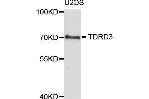 Western blot analysis of extracts of U2OS cells, using TDRD3 antibody (ABIN5973573) at 1/1000 dilution. (TDRD3 抗体)