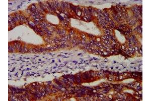 Immunohistochemistry (IHC) image for anti-POU Class 5 Homeobox 1 (POU5F1) (AA 1-360) antibody (ABIN7164068)