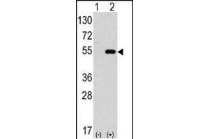 Western blot analysis of anti-hG4C- Pab 1810b in 293 cell line lysates transiently transfected with the ATG4C gene (2 μg/lane).