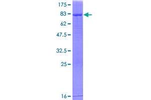 ALDH1A2 Protein (AA 1-480) (GST tag)