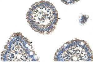 Human Intestine (UBE2L3 抗体  (C-Term))