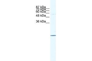 WB Suggested Anti-E2F6 Antibody   Titration: 1. (E2F6 抗体  (Middle Region))