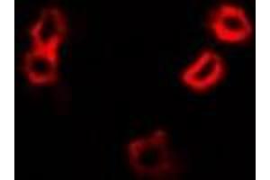 Immunofluorescent analysis of HAX1 staining in A549 cells. (HAX1 抗体)