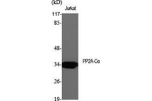 Western Blot (WB) analysis of specific cells using PP2A-Calpha Polyclonal Antibody.