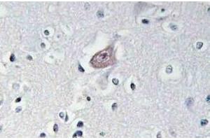 Immunohistochemistry analysis of p-Abl1/2 antibody (pTyr393/439) Cat. (ABL1 抗体  (pTyr393, pTyr439))