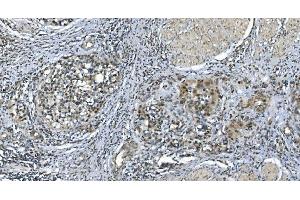 IHC analysis of LSM7 using anti-LSM7 antibody (ABIN7598937). (LSM7 抗体  (AA 1-103))