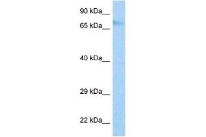 Host:  Rabbit  Target Name:  IFI204  Sample Tissue:  Mouse NIH3T3 Whole Cell  Antibody Dilution:  1ug/ml (Ifi204 抗体  (Middle Region))