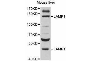 Western blot analysis of extracts of mouse liver, using LAMP1 antibody (ABIN4904197) at 1:500 dilution. (LAMP1 抗体)