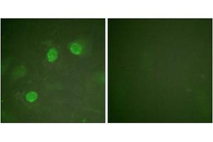 Immunofluorescence analysis of HeLa cells, using GATA3 antibody. (GATA3 抗体)