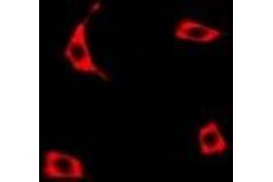 Immunofluorescent analysis of Transcobalamin-1 staining in U2OS cells. (TCN1 抗体)