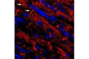 Expression of NaV1. (SCN5A 抗体  (Intracellular))