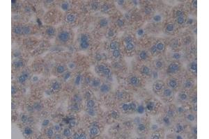 IHC-P analysis of Mouse Liver Tissue, with DAB staining. (FOS 抗体  (AA 6-240))