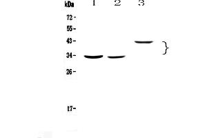 Western blot analysis of Regucalcin using anti-Regucalcin antibody . (Regucalcin 抗体)
