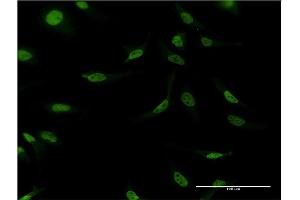Immunofluorescence (IF) image for anti-Cleavage Stimulation Factor, 3' Pre-RNA, Subunit 2, 64kDa (CSTF2) (AA 1-577) antibody (ABIN514732)
