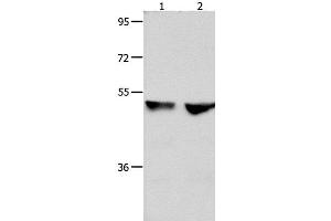 Western Blot analysis of 823 and Hela cell using CDK9 Polyclonal Antibody at dilution of 1:300 (CDK9 抗体)