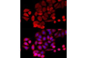 Immunofluorescence (IF) image for anti-P53-Induced Death Domain Protein (PIDD) (AA 1-85) antibody (ABIN1680710)