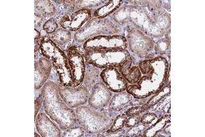 Immunohistochemical staining of human kidney with IL20RA polyclonal antibody  shows strong cytoplasmic positivity in renal tubules at 1:200-1:500 dilution. (IL20RA 抗体)