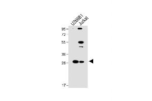 All lanes : Anti-LTM5 Antibody (N-term) at 1:1000 dilution Lane 1: U266B1 whole cell lysate Lane 2: Jurkat whole cell lysate Lysates/proteins at 20 μg per lane. (LAPTM5 抗体  (N-Term))