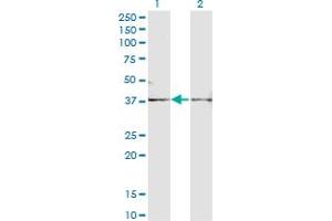 Western Blot analysis of FST expression in transfected 293T cell line by FST monoclonal antibody (M01A), clone 1G4. (Follistatin 抗体  (AA 1-344))