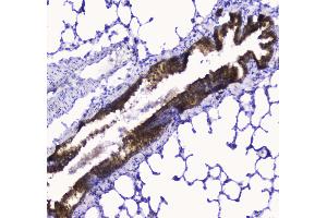 IHC analysis of COX IV using anti-COX IV antibody . (COX IV 抗体  (AA 59-169))
