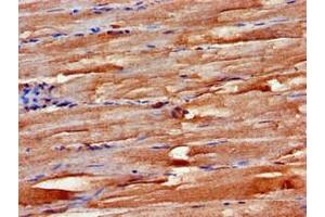 Immunohistochemistry of paraffin-embedded human skeletal muscle tissue using ABIN7152499 at dilution of 1:100 (FBXW2 抗体  (AA 72-340))