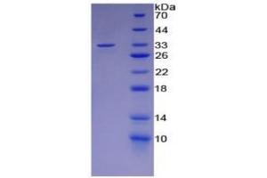 SDS-PAGE (SDS) image for Lipopolysaccharide Binding Protein (LBP) ELISA Kit (ABIN6574276)