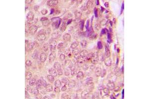 Immunohistochemistry (IHC) image for anti-Signal Transducer and Activator of Transcription 3 (Acute-Phase Response Factor) (STAT3) (C-Term), (pSer727) antibody (ABIN7297040)
