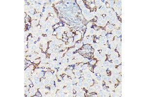 Immunohistochemistry of paraffin-embedded rat ovary using CD34 Rabbit mAb (ABIN7266187) at dilution of 1:100 (40x lens).