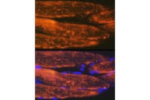 Immunofluorescence analysis of rat bone marrow cells using  Rabbit mAb (ABIN7265398) at dilution of 1:100 (40x lens). (ACTN3 抗体)