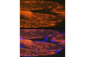 Immunofluorescence analysis of rat bone marrow cells using  Rabbit mAb (ABIN7265398) at dilution of 1:100 (40x lens).