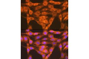 Immunofluorescence analysis of C6 cells using RA + RB Rabbit mAb (ABIN7269853) at dilution of 1:100 (40x lens). (RAP1A + RAP1B 抗体)