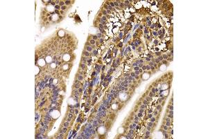 Immunohistochemistry of paraffin-embedded mouse ileum using CLASP1 antibody (ABIN5974258) at dilution of 1/100 (40x lens). (CLASP1 抗体)