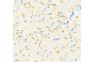 Immunohistochemistry (Paraffin-embedded Sections) (IHC (p)) image for anti-threonine Synthase-Like 2 (THNSL2) antibody (ABIN7075893)