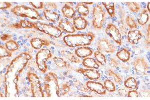 Immunohistochemistry of paraffin-embedded Rat kidney using CYB5A Polyclonal Antibody at dilution of 1:100 (40x lens). (CYB5A 抗体)