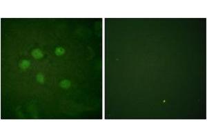 Immunofluorescence analysis of HuvEc cells, using AOS1 Antibody. (SAE1 抗体  (AA 221-270))