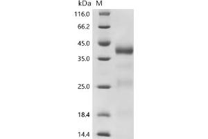 (Tris-Glycine gel) Discontinuous SDS-PAGE (reduced) with 5 % enrichment gel and 15 % separation gel.