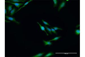 Immunofluorescence of purified MaxPab antibody to ELP3 on HeLa cell. (ELP3/KAT9 抗体  (AA 1-547))