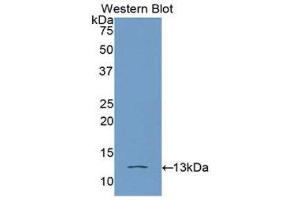 Western Blotting (WB) image for anti-High Mobility Group AT-Hook 1 (HMGA1) (AA 3-107) antibody (ABIN3205549) (HMGA1 抗体  (AA 3-107))