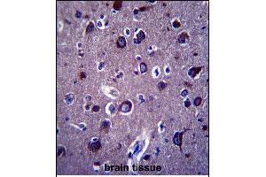 P Antibody (Center) 13689c immunohistochemistry analysis in formalin fixed and paraffin embedded human brain tissue followed by peroxidase conjugation of the secondary antibody and DAB staining. (APP 抗体  (AA 333-362))